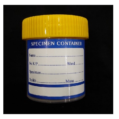 URINE CONTAINERS 60ML